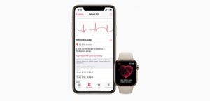 Fibrillazione atriale Apple